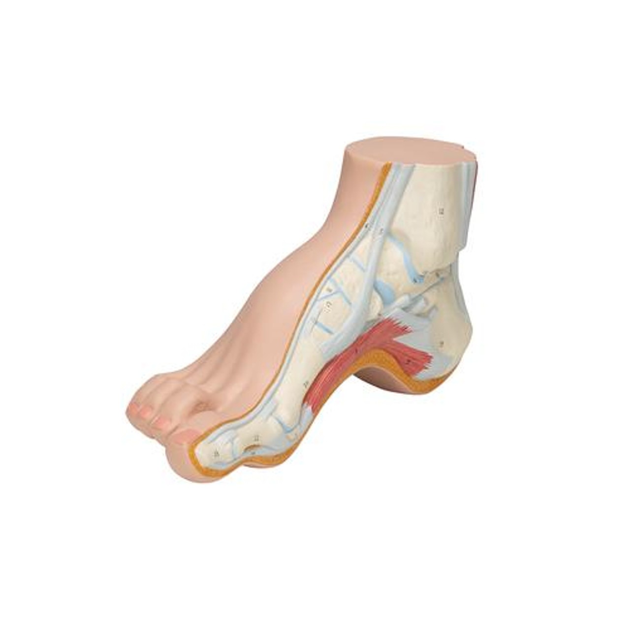 Hollow Foot Pes Cavus Anatomy Model - Left Side View