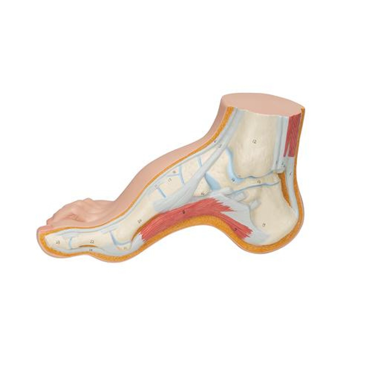 Hollow Foot Pes Cavus Anatomy Model - Left Side View