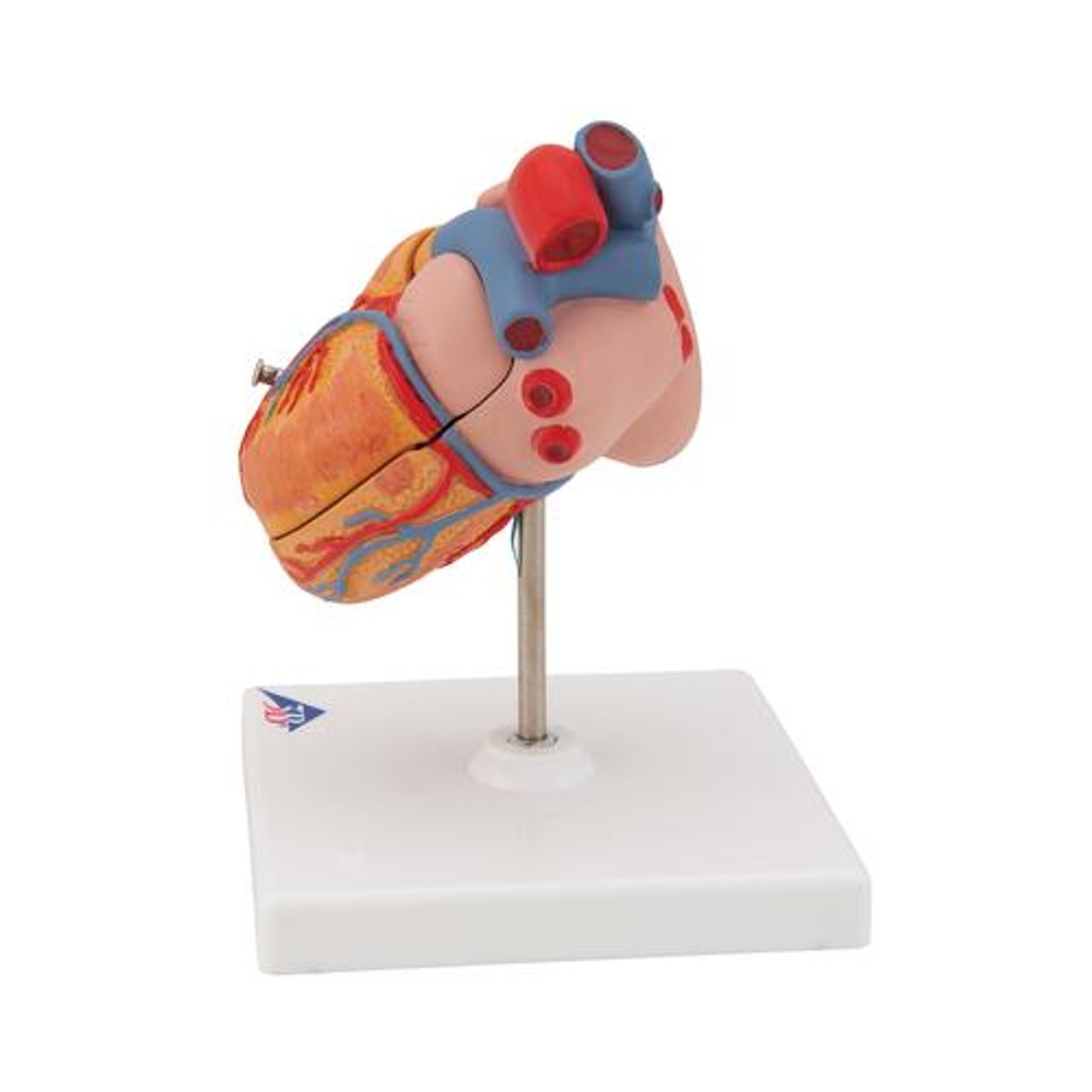 Classic Human Heart Anatomy Model With Left Ventricular Hypertrophy