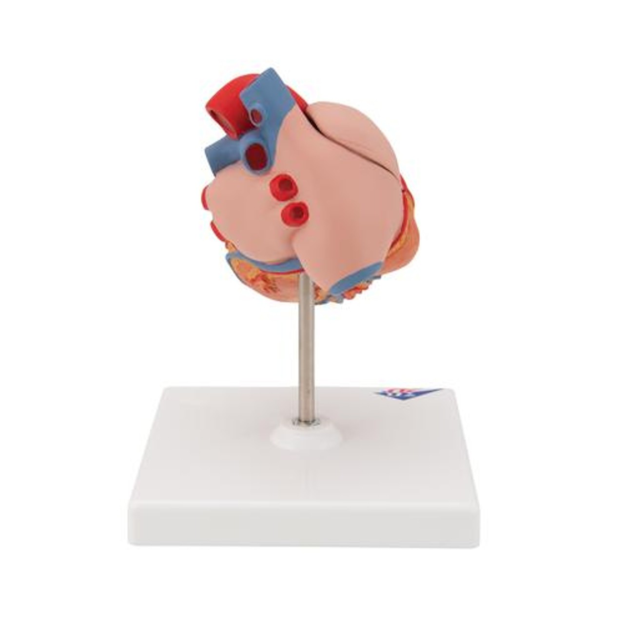 Classic Human Heart Anatomy Model With Left Ventricular Hypertrophy
