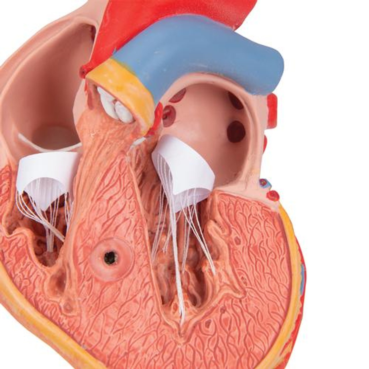 Classic Human Heart Anatomy Model With Left Ventricular Hypertrophy