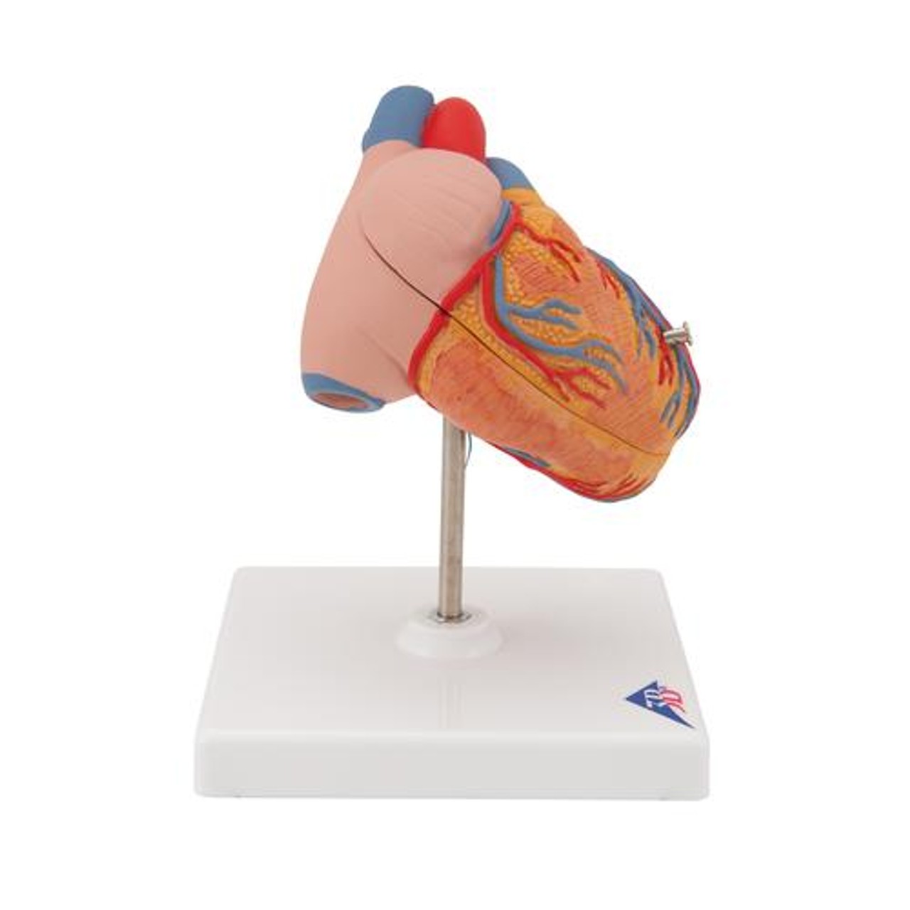 Classic Human Heart Anatomy Model With Left Ventricular Hypertrophy