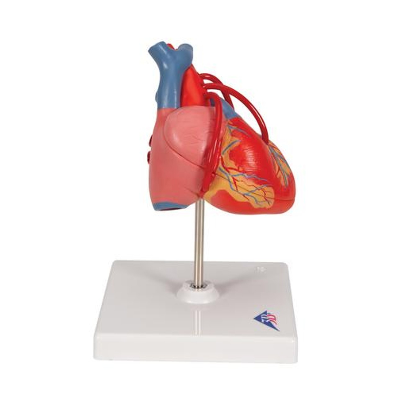 Classic Heart Anatomy Model With Bypass