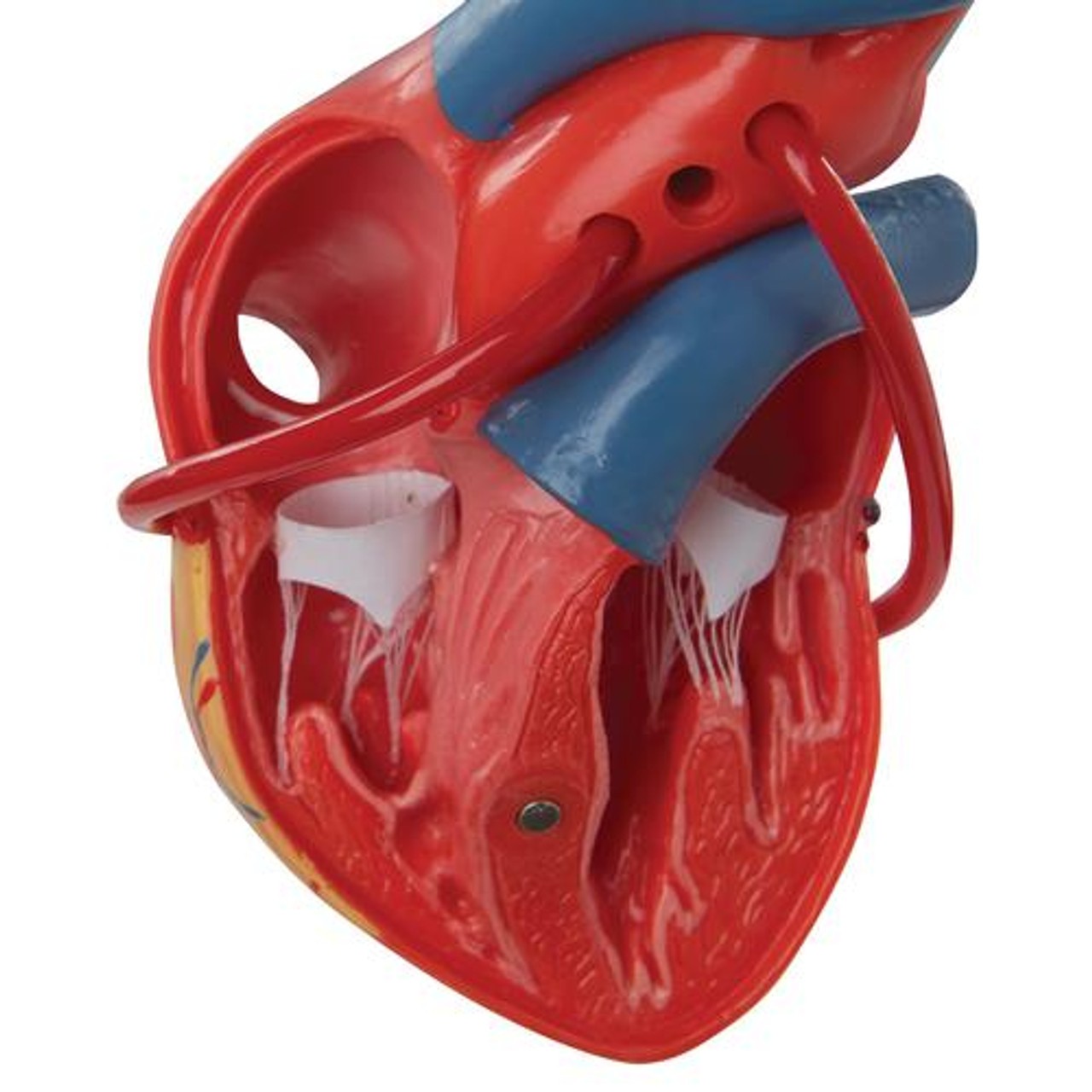 Classic Heart Anatomy Model With Bypass