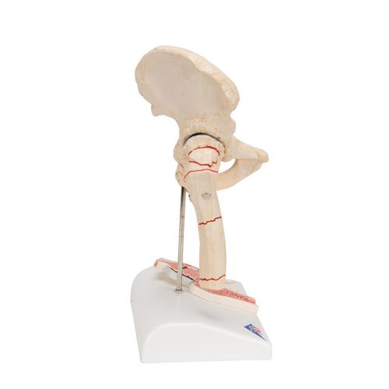 Femoral Fracture Anatomy Model - Right Side View