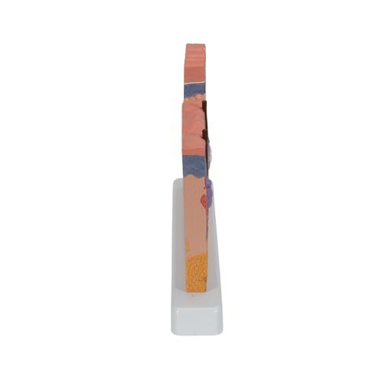 Skin Section Relief Model