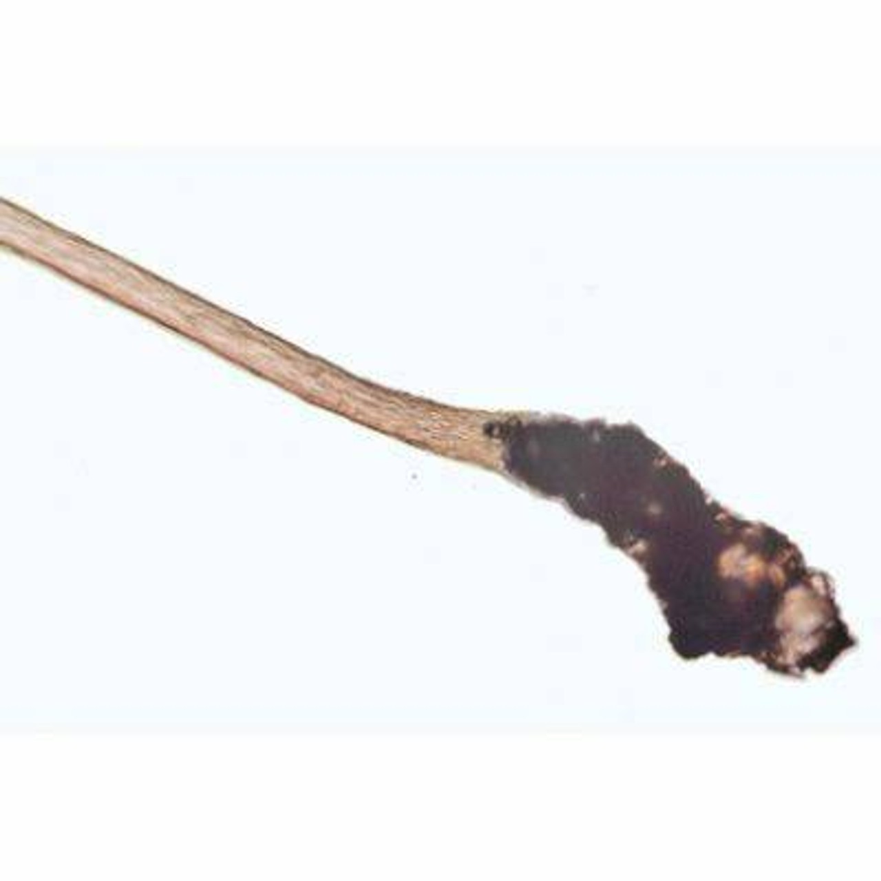 Human Scalp and Hair - English Slides