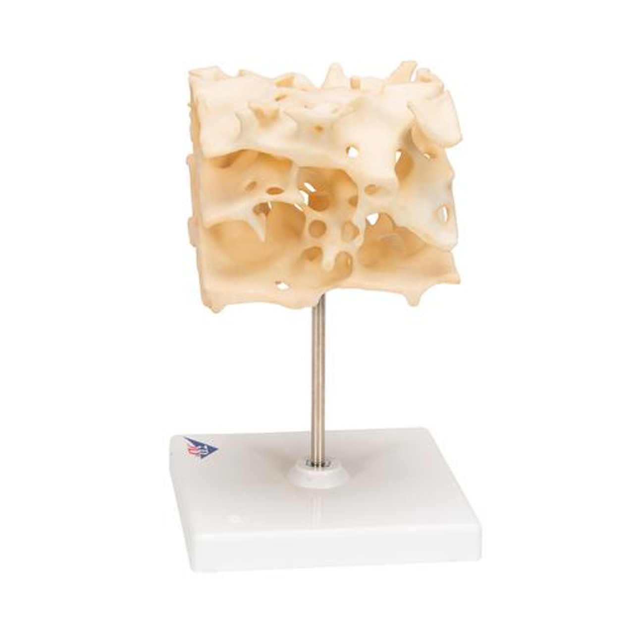 Cancellous Bone - Left Side View