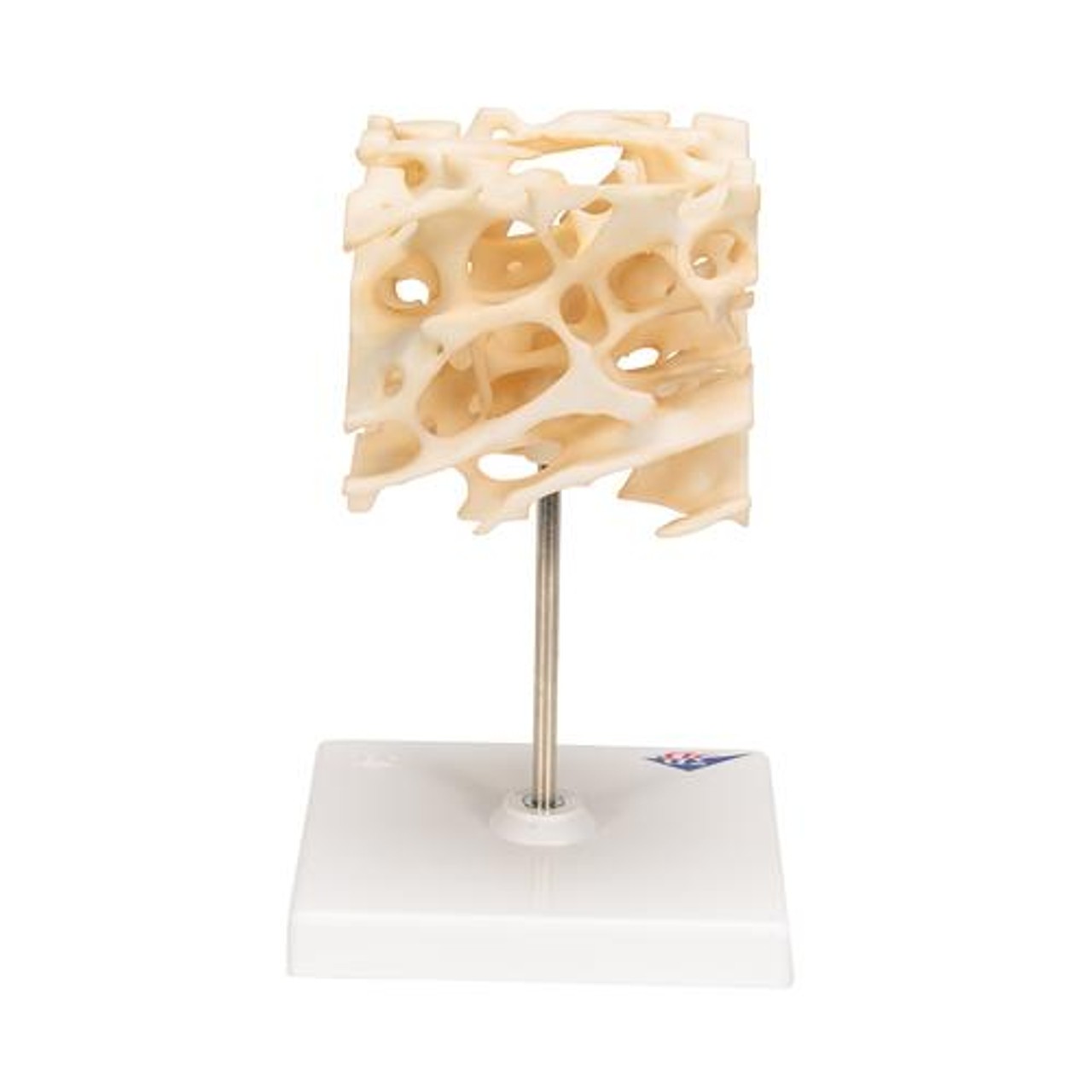 Cancellous Bone - Back Side View