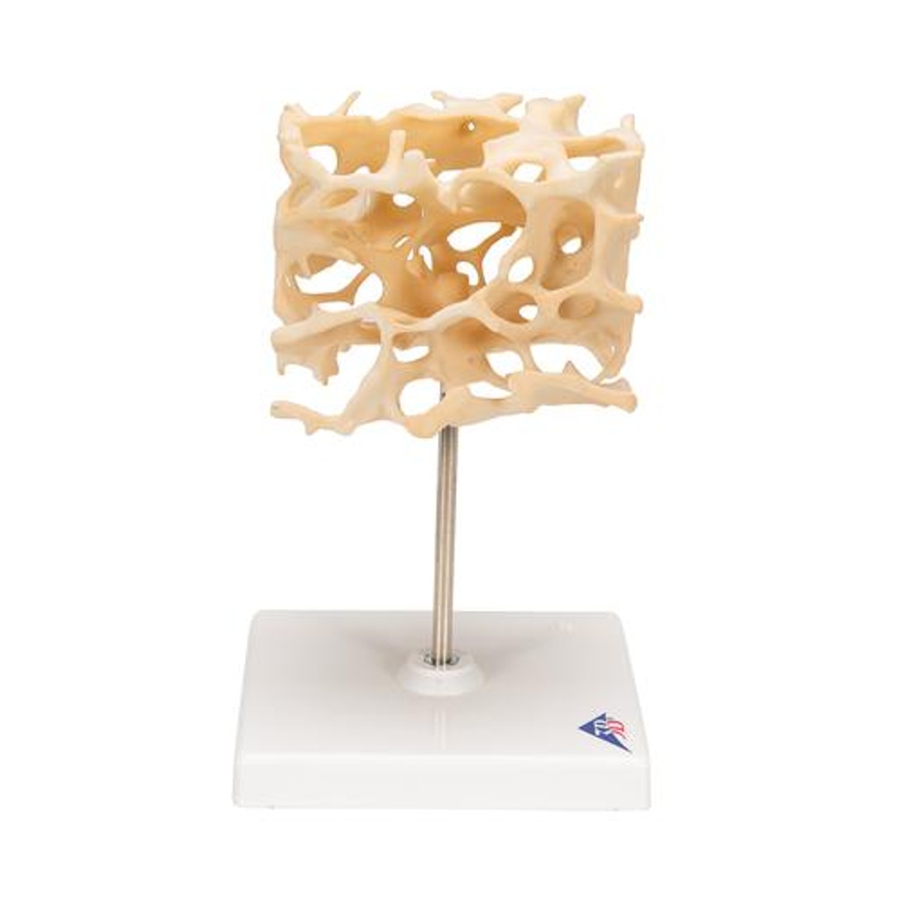 Cancellous Bone - Right Side View
