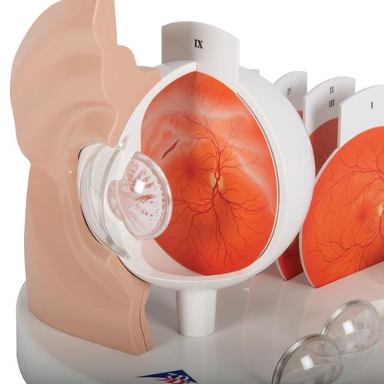 Pathological Eye