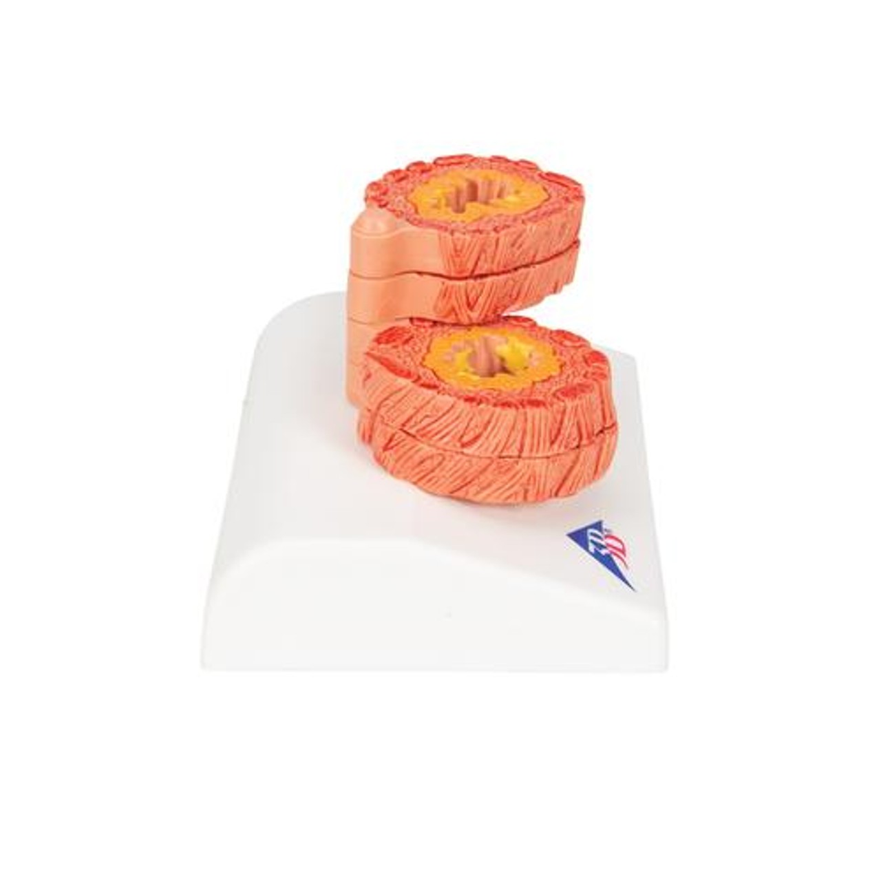 COPD Model - Right Side View