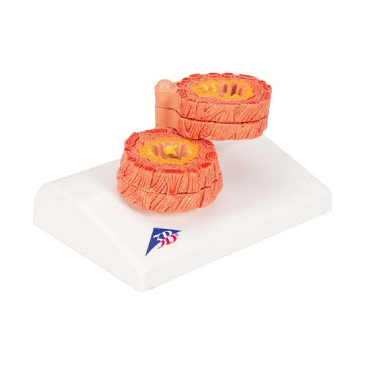COPD Model - Right Side View
