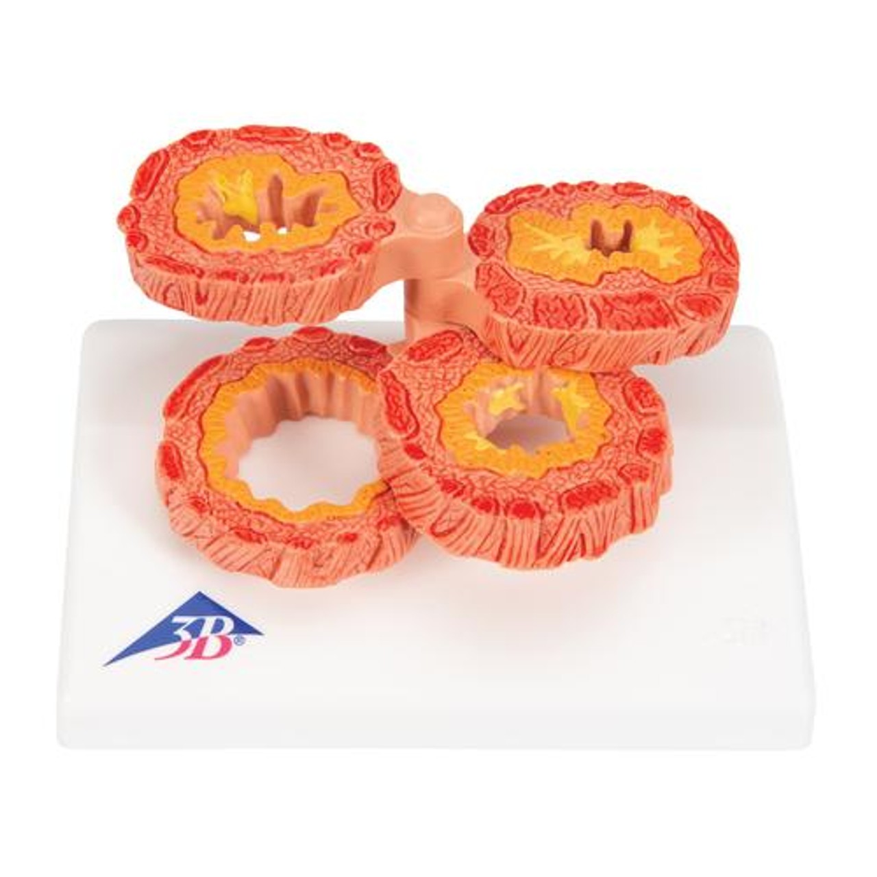 COPD Model - Zoom View