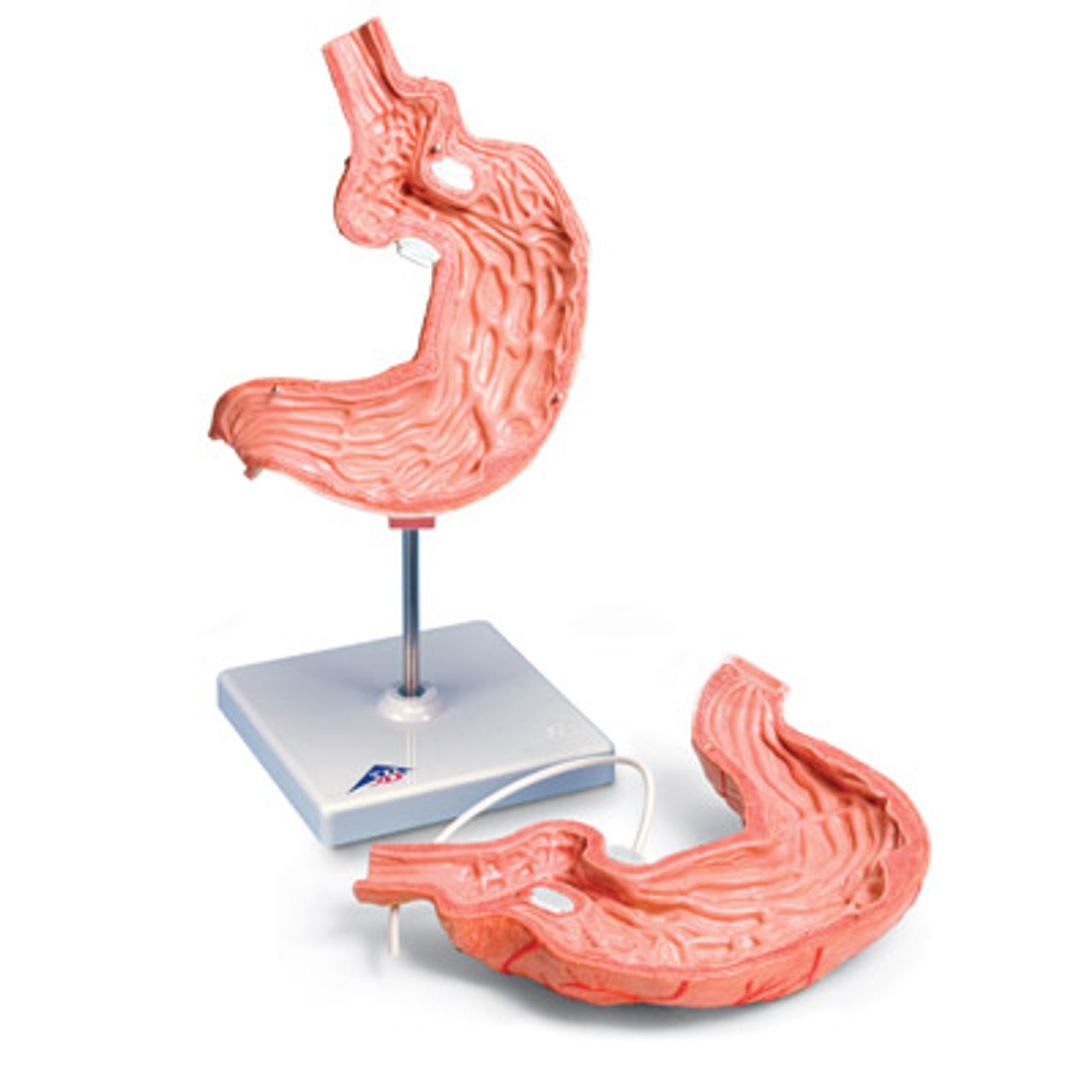 Gastric Band Model