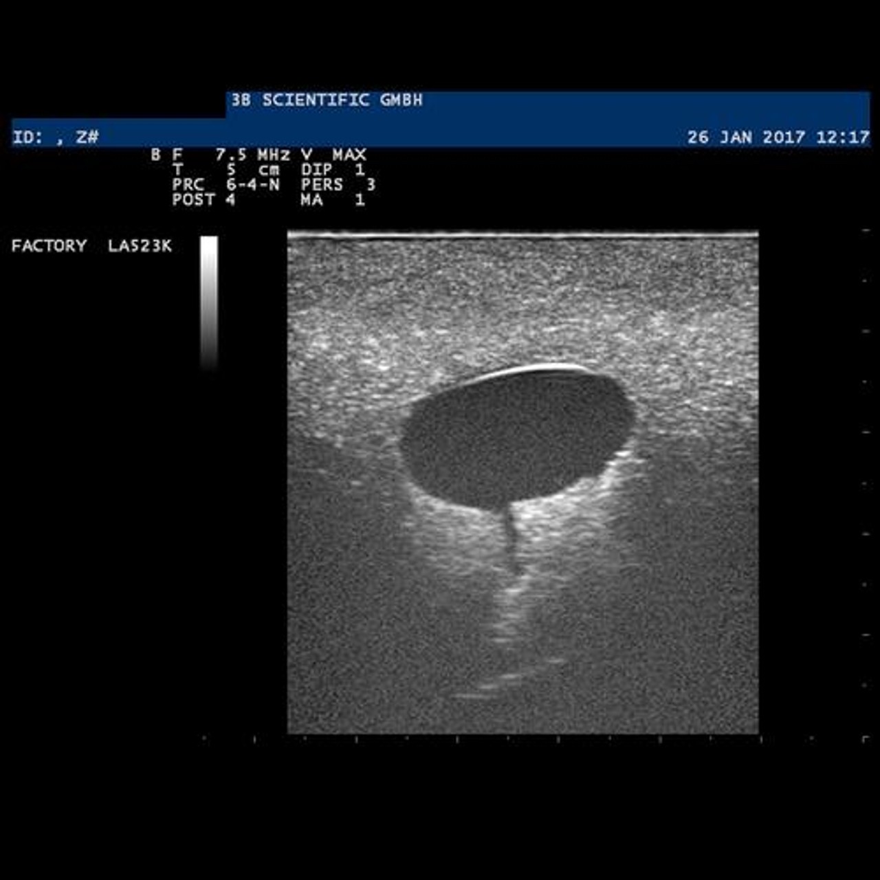 SONOtrain Breast Model with Systs