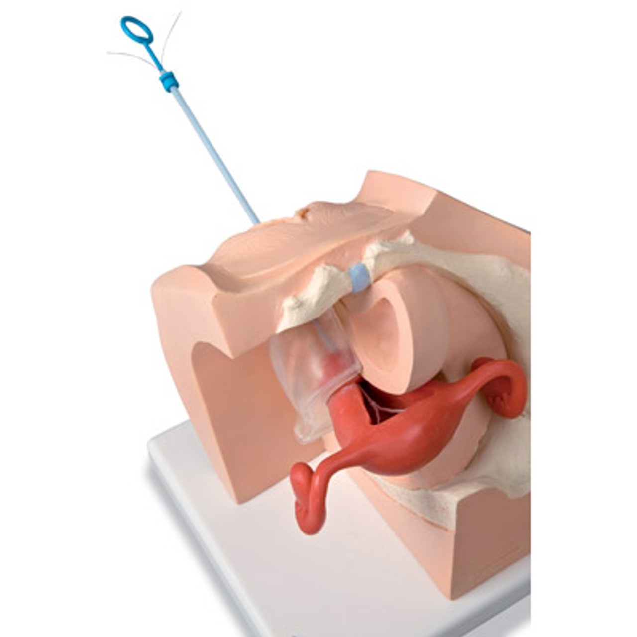 Model for Gynecological Patient Education
