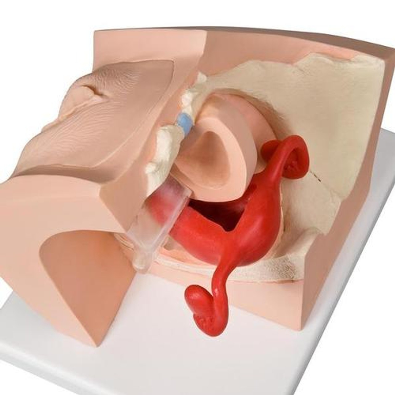Model for Gynecological Patient Education