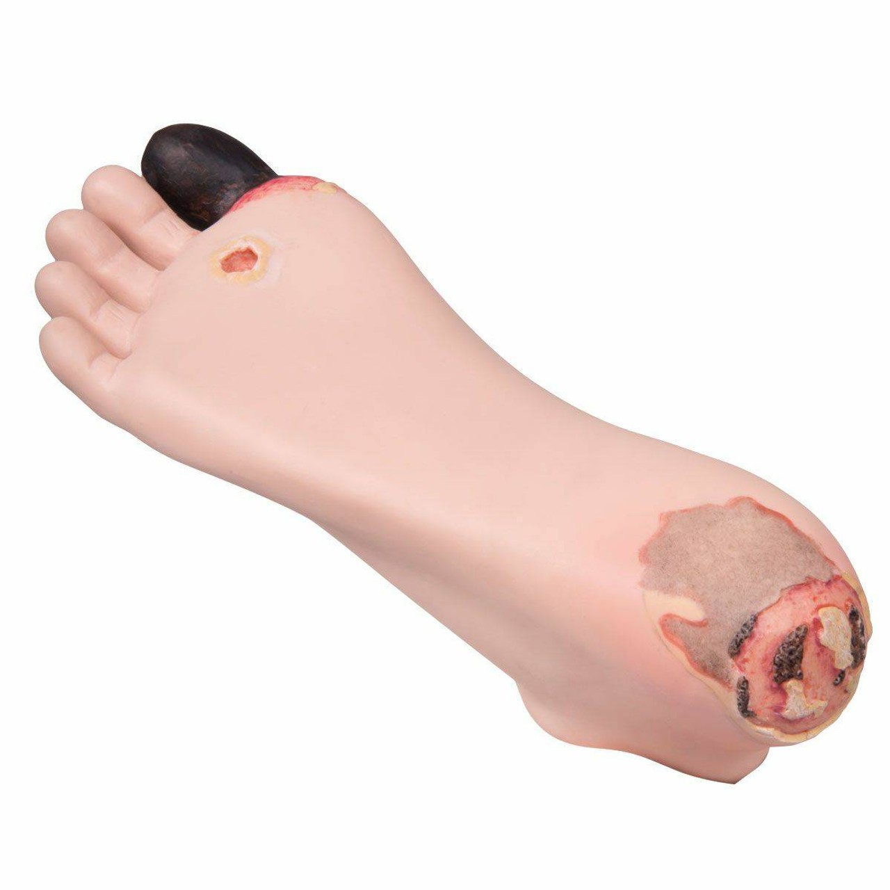Diabetic Foot Treatment Trainer Diabetic Foot Treatment Trainer