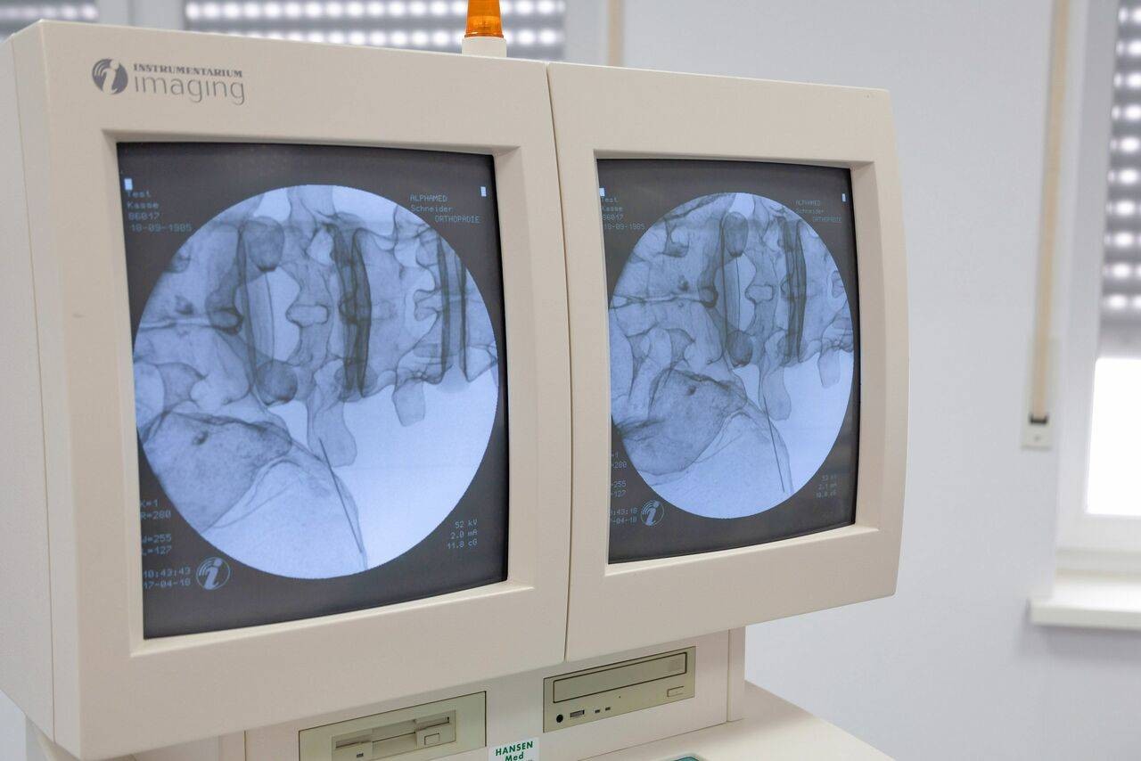 Image Guided Lumbar Spinal Injection Trainer