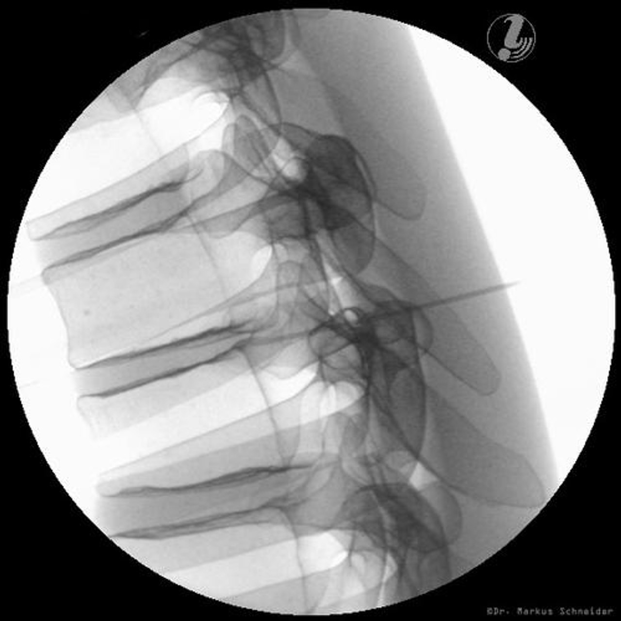 Image Guided Thoracic Spinal Injection Trainer