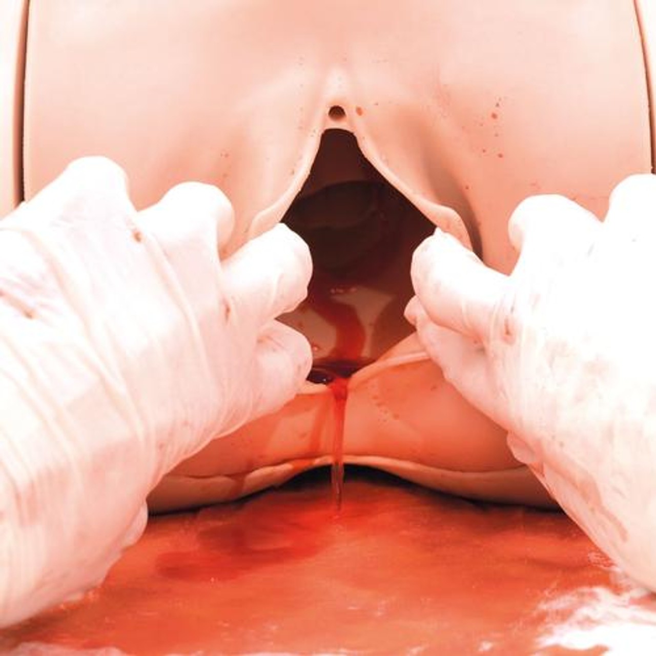 Postpartum Hermorrhage Trainer