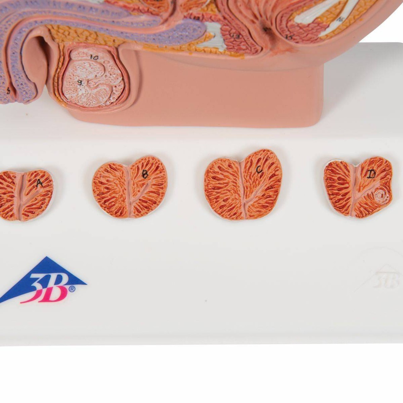 Miniature Prostate Anatomy Model