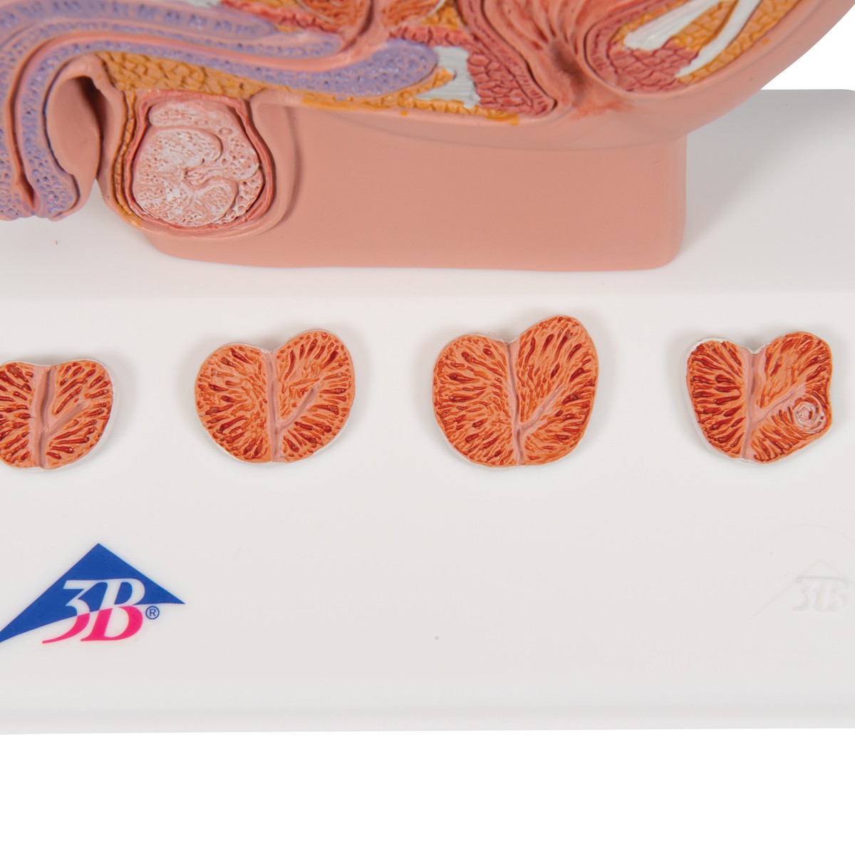 Miniature Prostate Anatomy Model