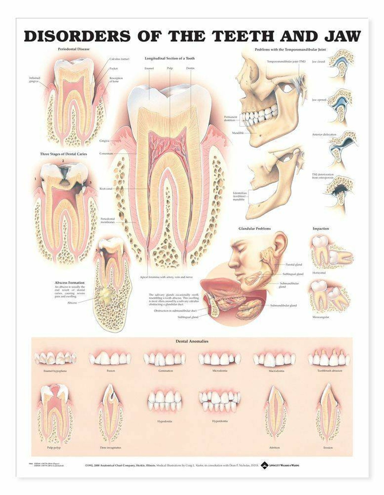 Disorders Of The Teeth and Jaw Laminated Anatomical Chart