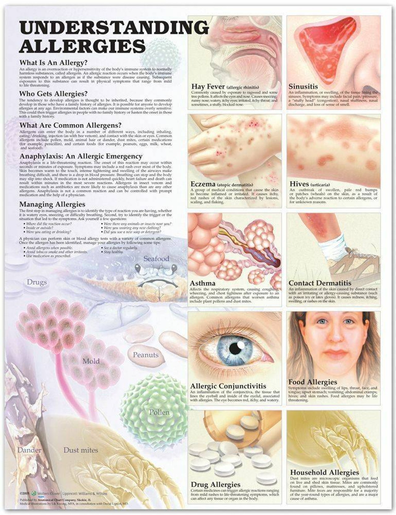Understanding Allergies Laminated Anatomical Chart - 2nd Edition