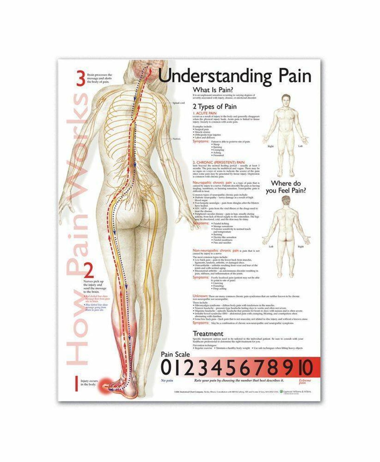 Understanding Pain Laminated Anatomical Chart