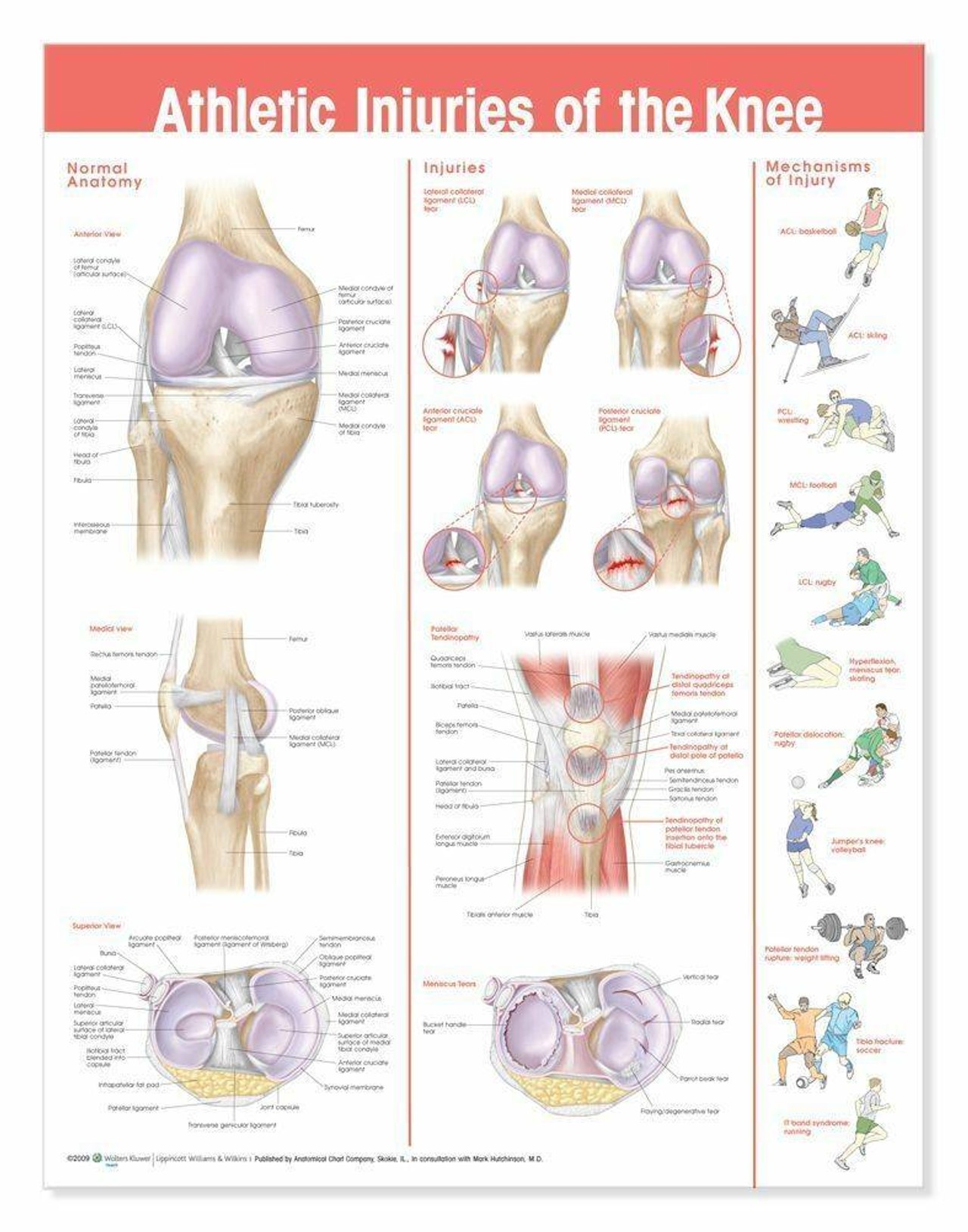 Athletic Injuries Of The Knee Laminated Anatomical Chart