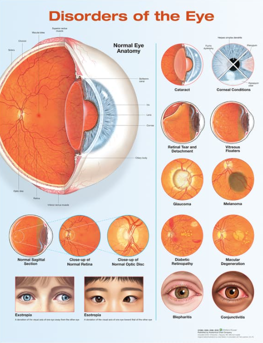 Disorders Of The Eye Laminated Anatomical Chart - 3rd Edition