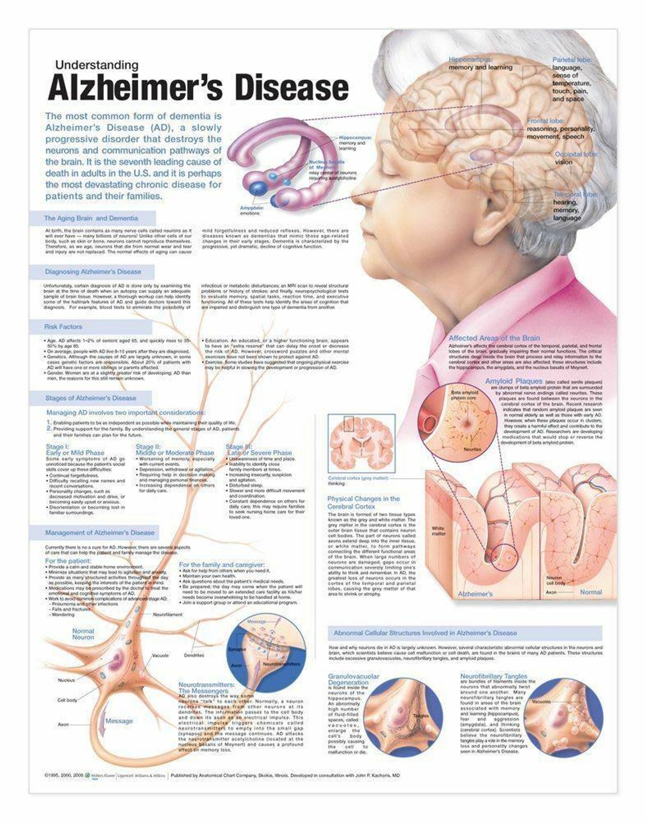 Understanding Alzheimers Laminated Anatomical Chart