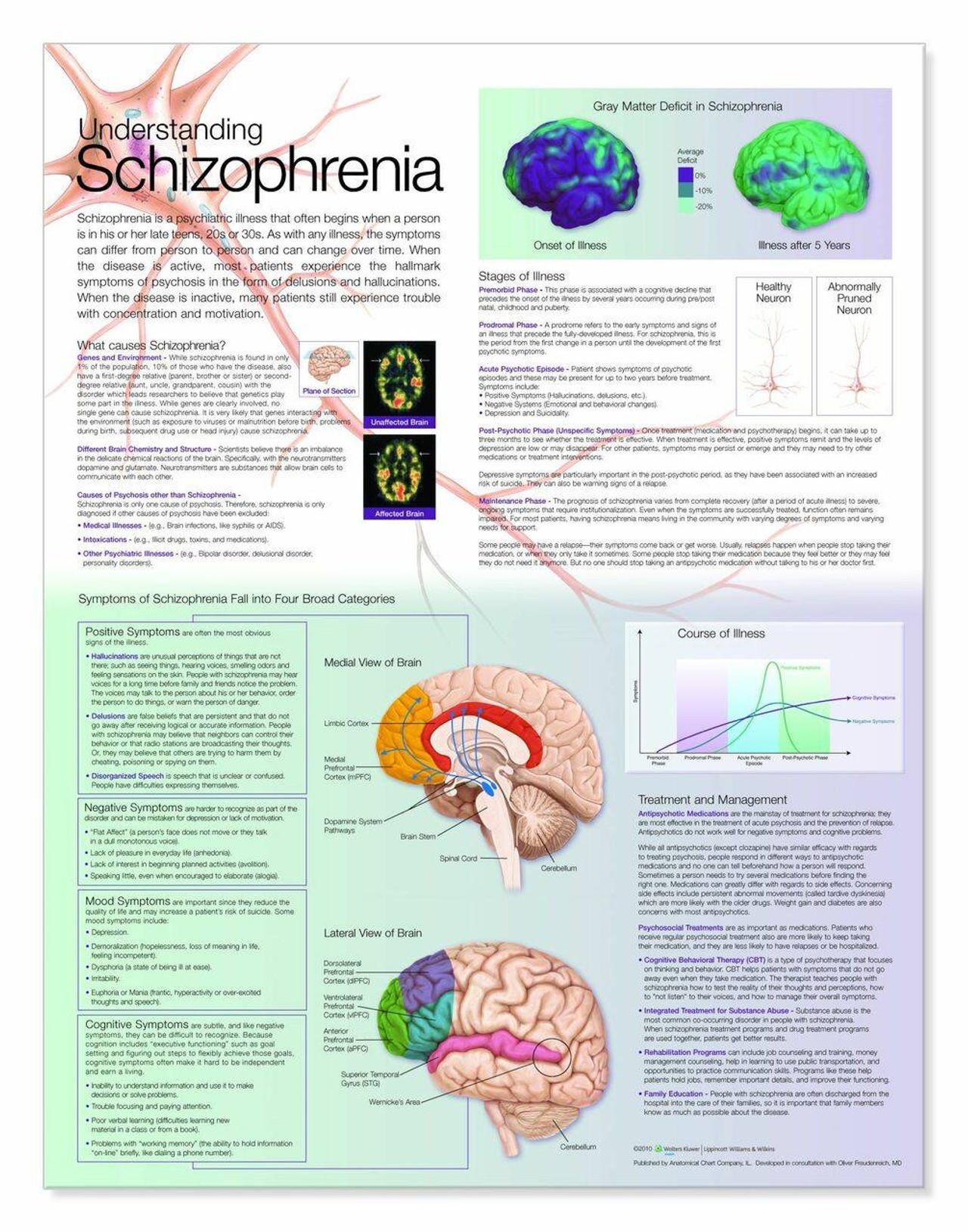 Understanding Schizophrenia Laminated Anatomical Chart