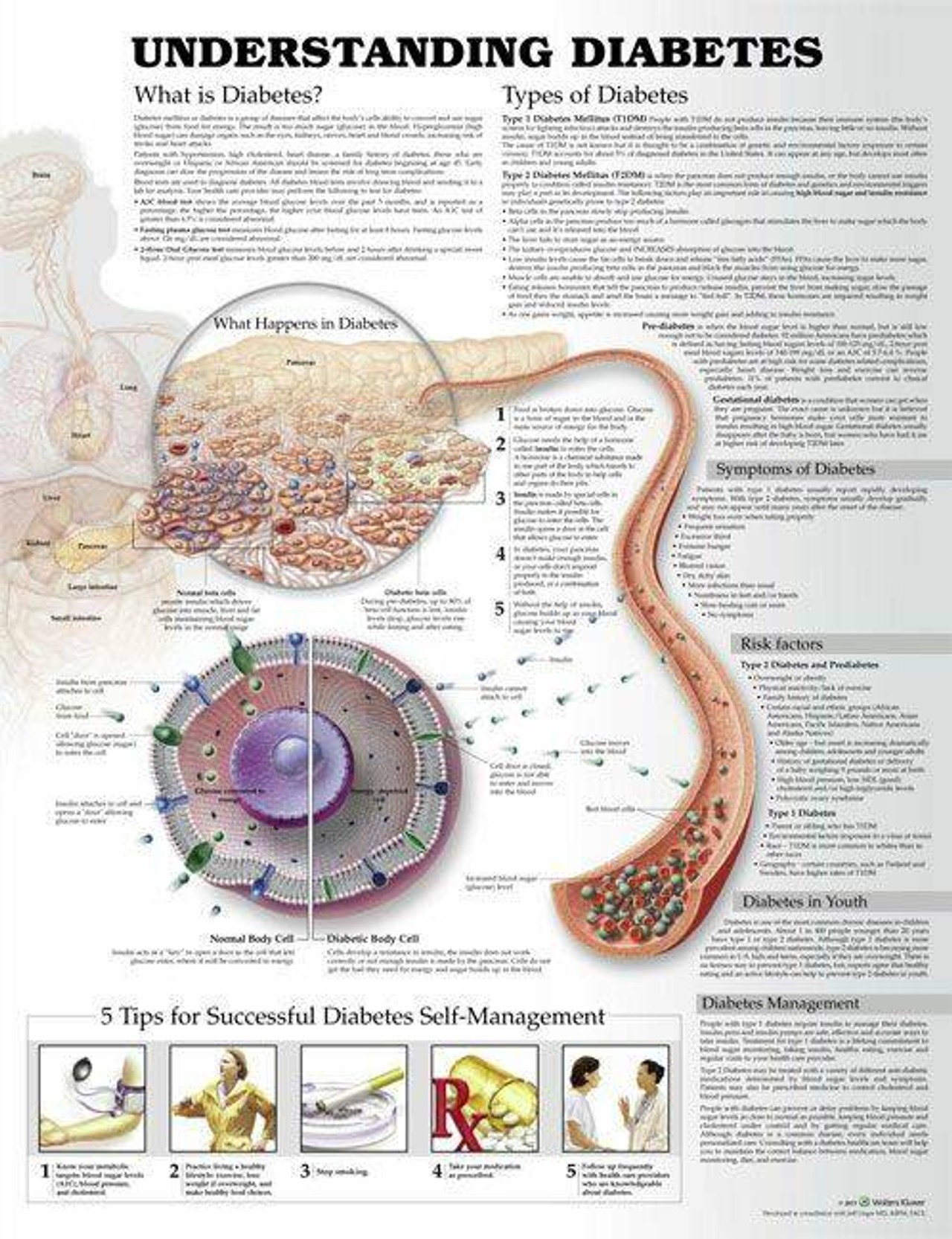 Understanding Diabetes Laminated Anatomical Chart - 3rd Edition