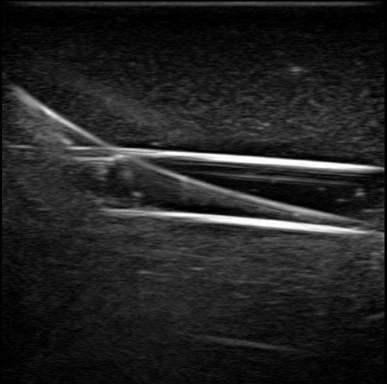 Gen II PICC with IV and Arterial Line Vascular Access Ultrasound Trainer