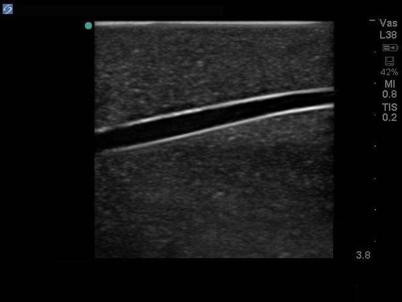 Branched 4 Vessel Ultrasound Training Block Model