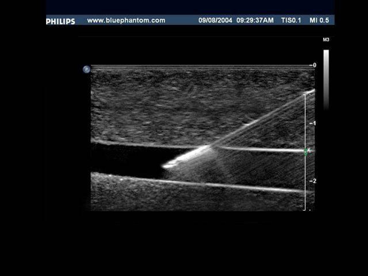 Branched 4 Vessel Ultrasound Training Block Model