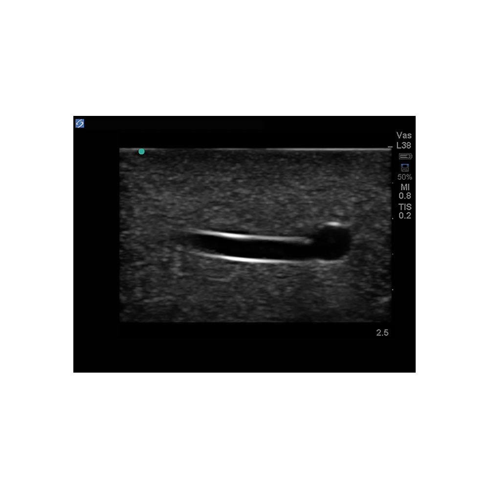 Branched 4 Vessel Ultrasound Training Block Model