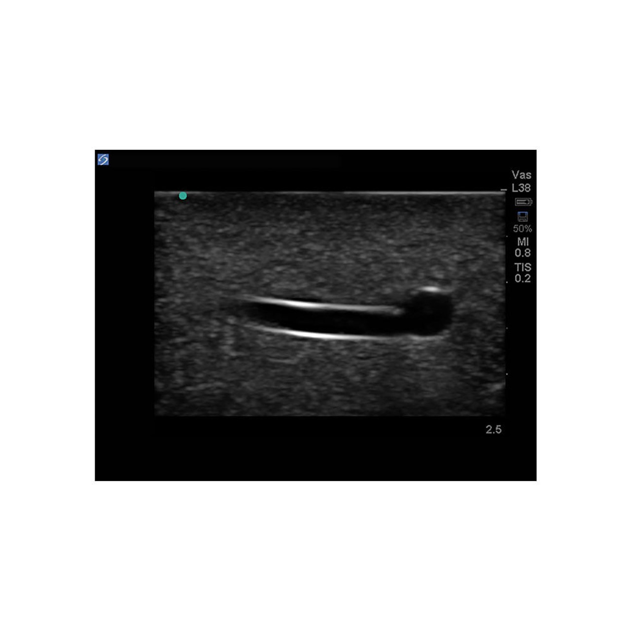 Branched 4 Vessel Ultrasound Training Block Model