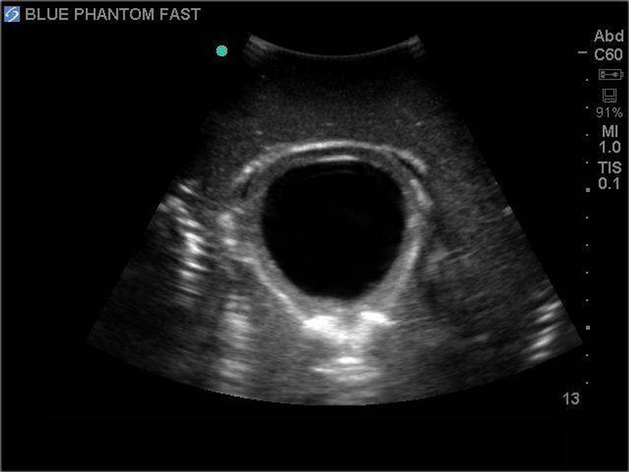 FAST Exam Real Time Ultrasound Training Model