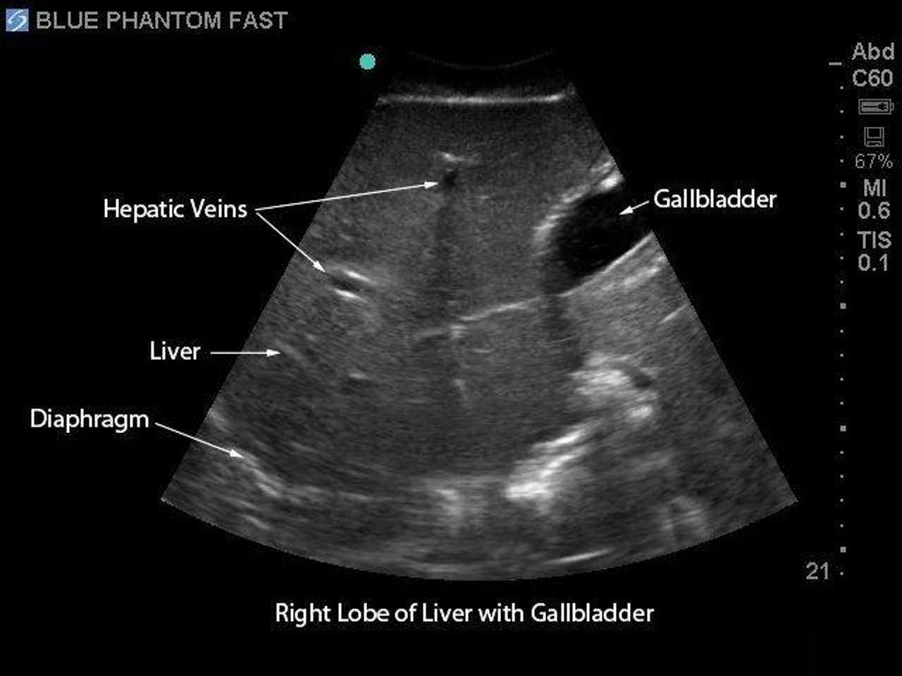 FAST Exam Real Time Ultrasound Training Model