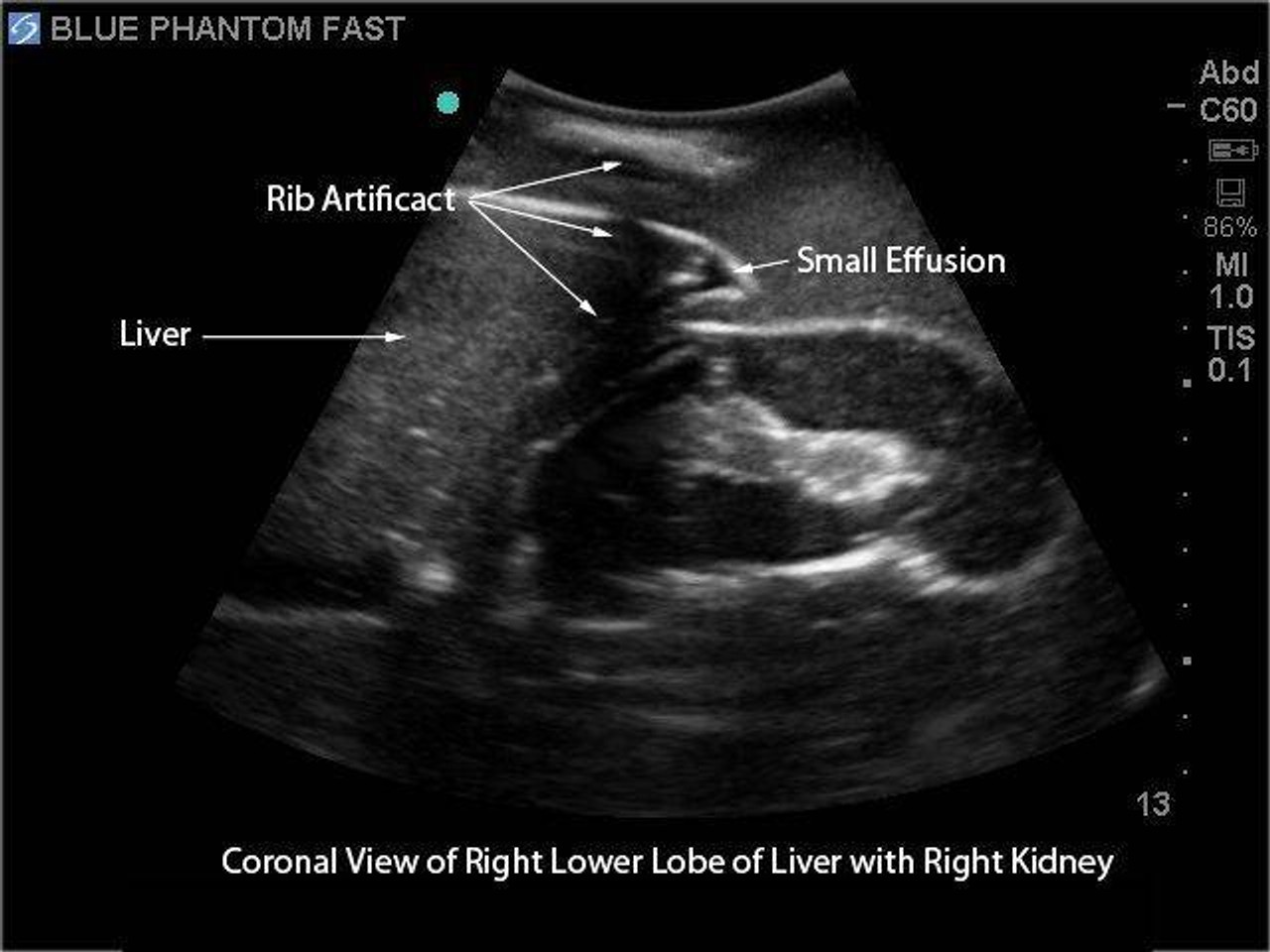 FAST Exam Real Time Ultrasound Training Model