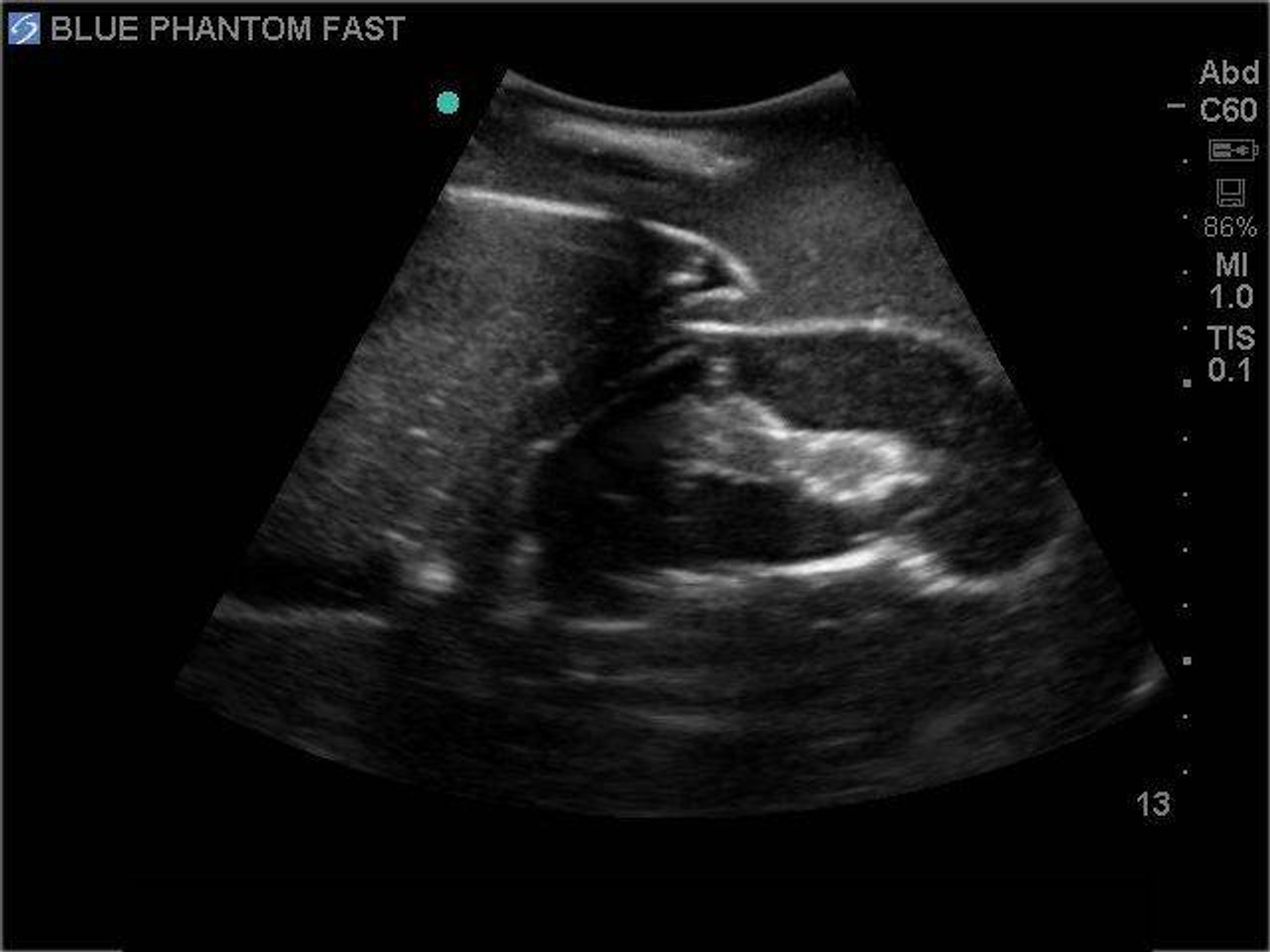 FAST Exam Real Time Ultrasound Training Model