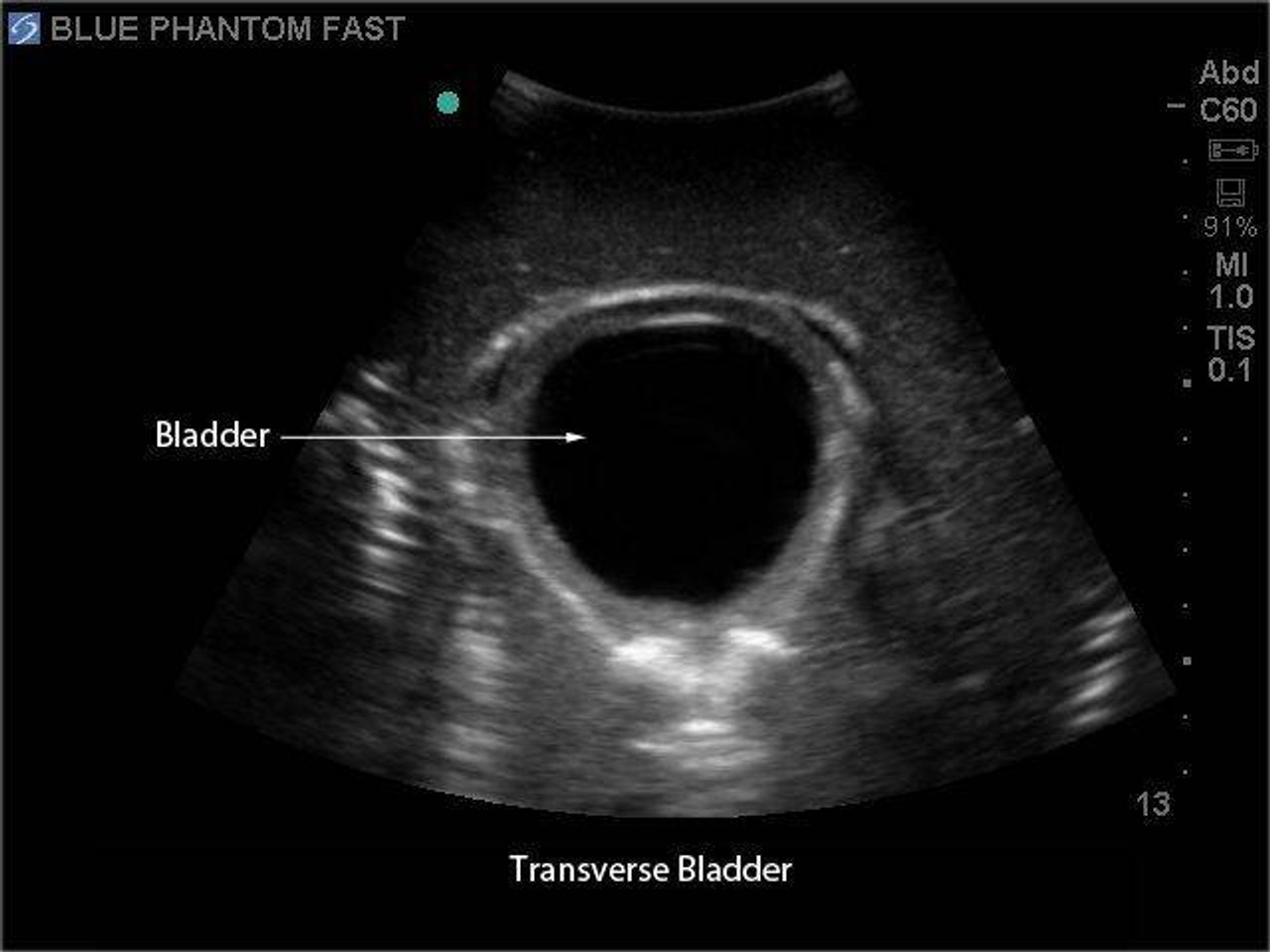 FAST Exam Real Time Ultrasound Training Model
