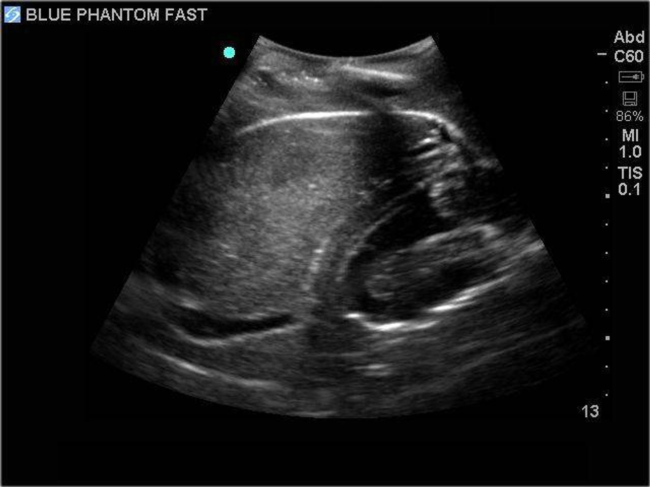 FAST Exam Real Time Ultrasound Training Model