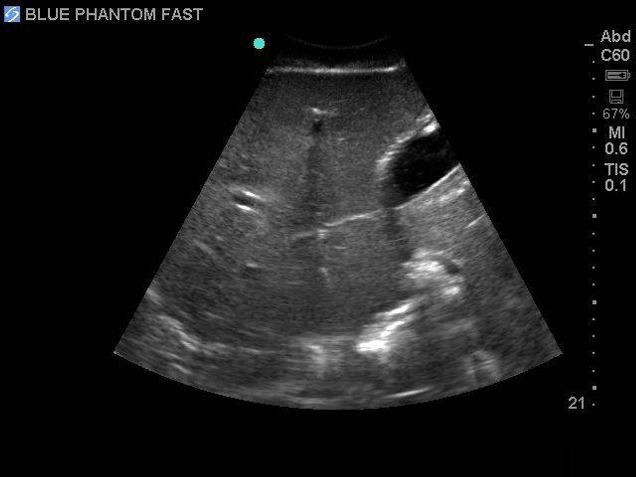 FAST Exam Real Time Ultrasound Training Model