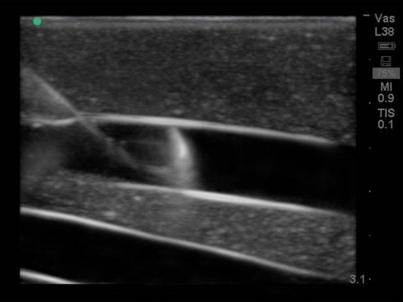 Internal Jugular Central Line Ultrasound Manikin