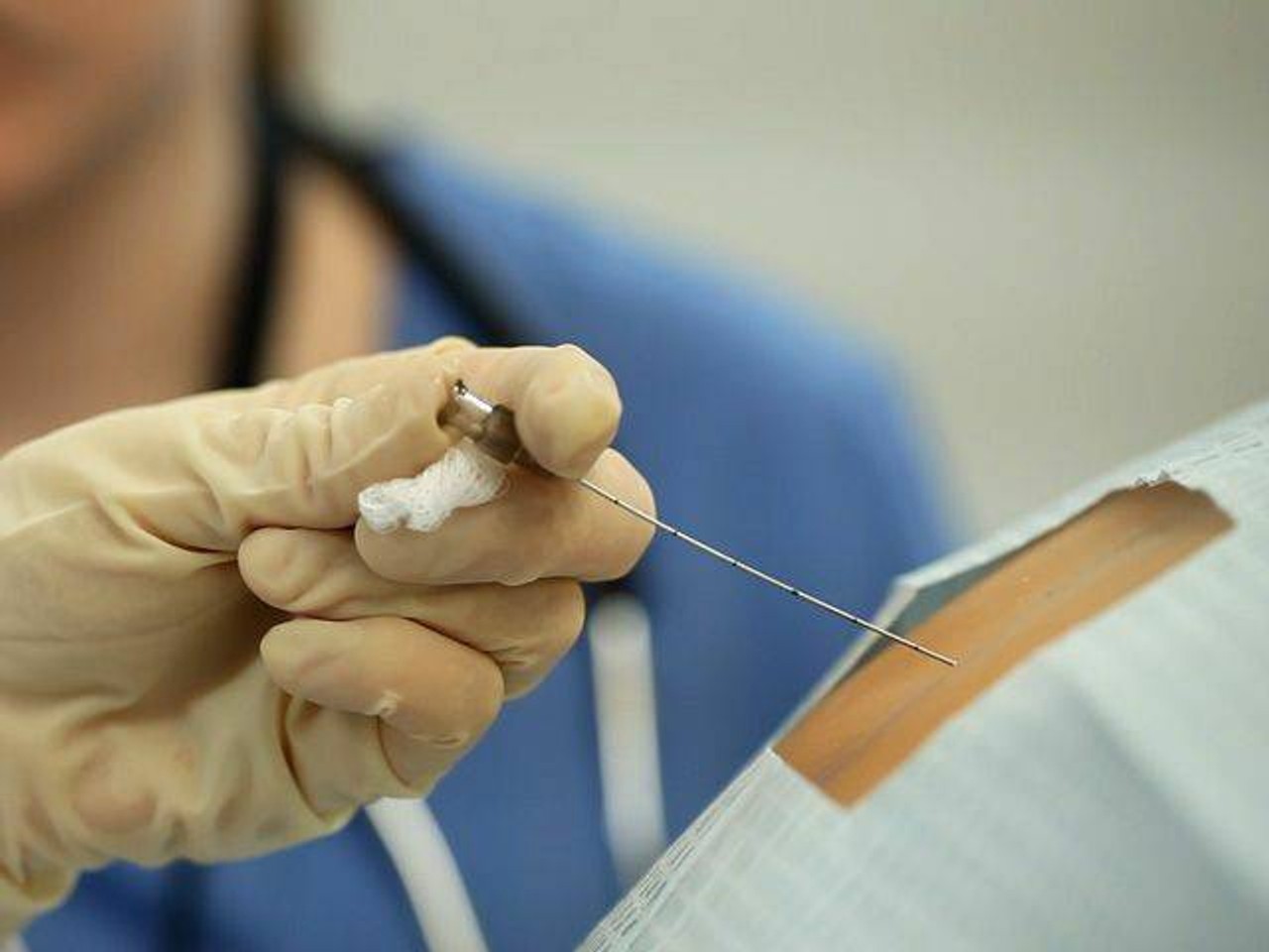 Lumbar Puncture and Spinal Epidural Replacement Tissue